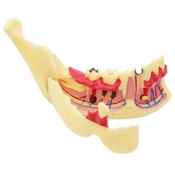 Dental Tratamento Endodôntico Modelo Do Lado Direito Da Mandíbula Tecido Anatômica Modelo De Anatomia Da Gengiva, Dentes De Modelos Para O Estudo Do Ensino